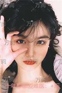 sana黑暗精灵